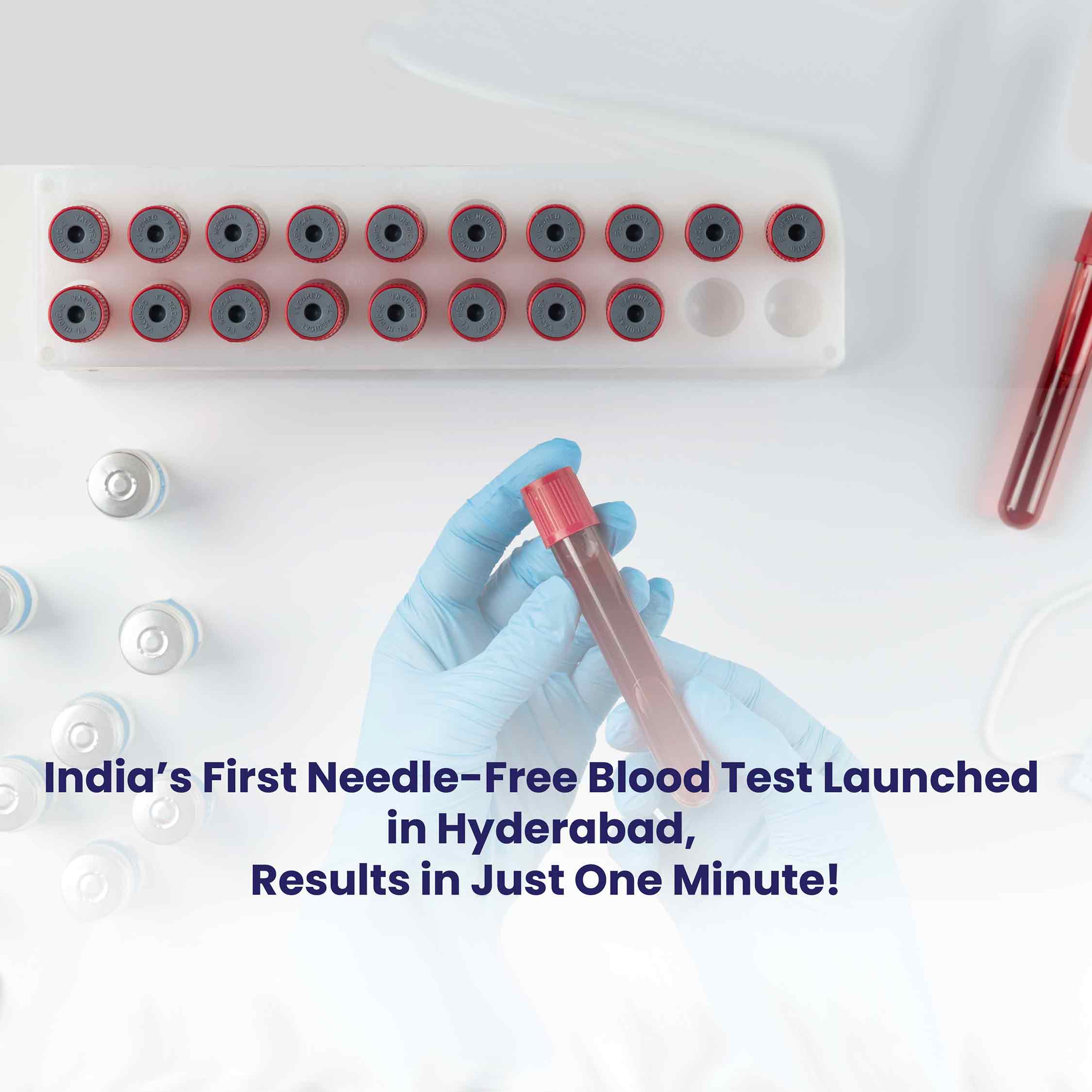 blood-test